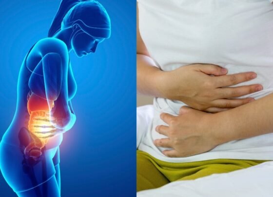 Descubra por que o inchaço abdominal acontece, como aliviar os sintomas e quando é necessário buscar ajuda médica