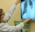 Baixo financiamento mundial ameaça combate à tuberculose